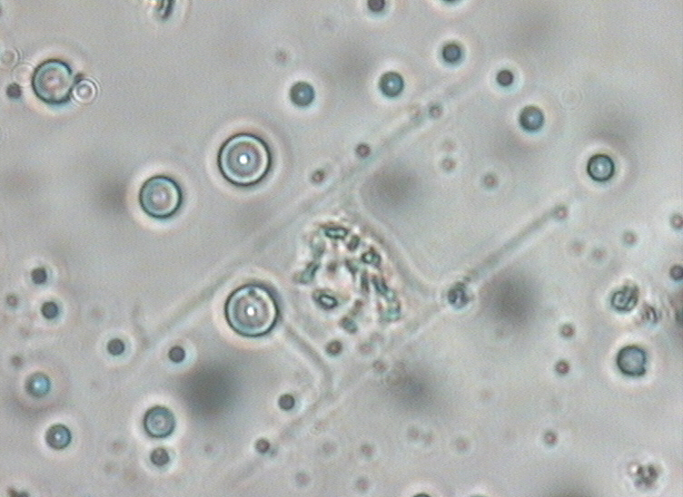 Dictyocha speculum